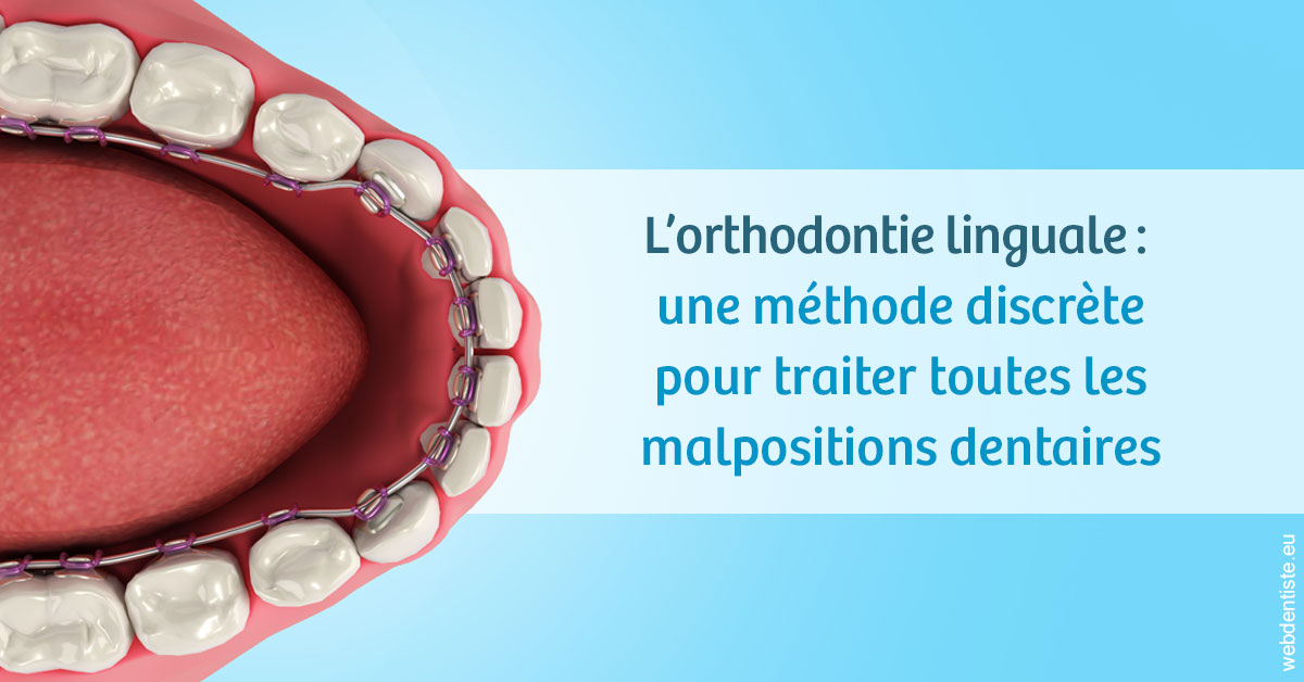 https://dr-patrice-gasser.chirurgiens-dentistes.fr/L'orthodontie linguale 1