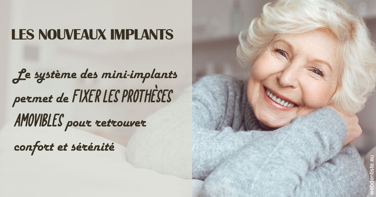 https://dr-patrice-gasser.chirurgiens-dentistes.fr/Les nouveaux implants 1