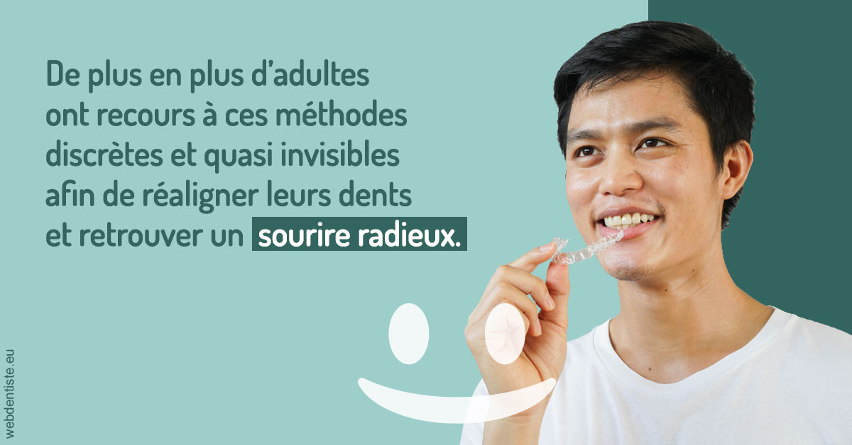 https://dr-patrice-gasser.chirurgiens-dentistes.fr/Gouttières sourire radieux 2