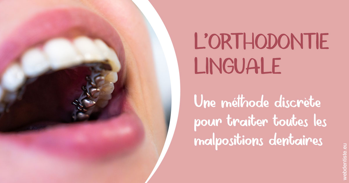 https://dr-patrice-gasser.chirurgiens-dentistes.fr/L'orthodontie linguale 2