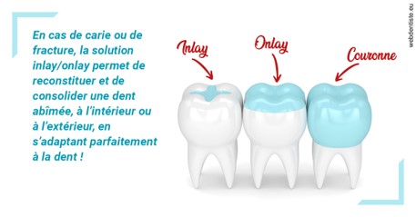 https://dr-patrice-gasser.chirurgiens-dentistes.fr/L'INLAY ou l'ONLAY