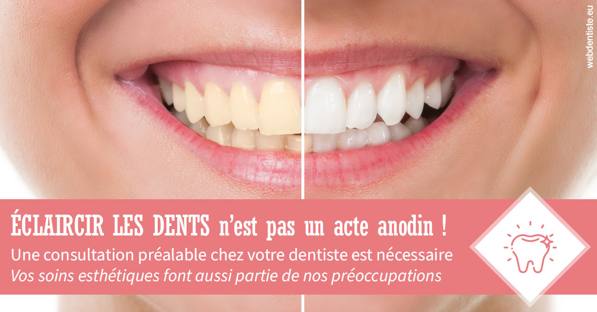 https://dr-patrice-gasser.chirurgiens-dentistes.fr/Eclaircir les dents 1