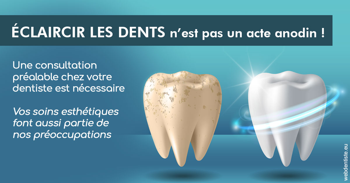 https://dr-patrice-gasser.chirurgiens-dentistes.fr/Eclaircir les dents 2