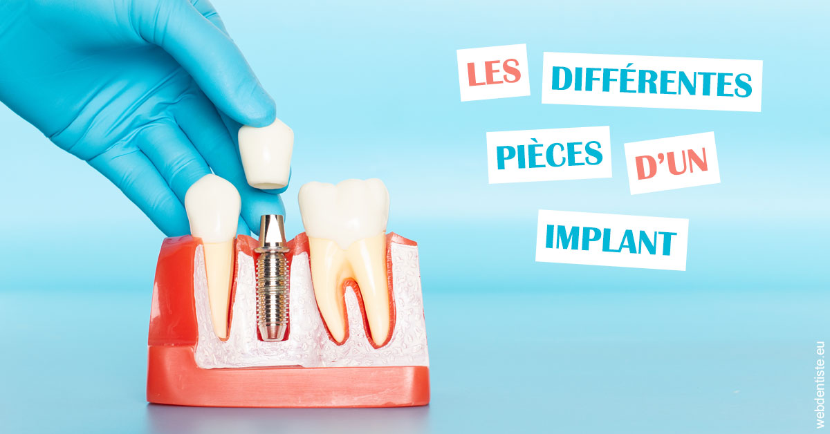 https://dr-patrice-gasser.chirurgiens-dentistes.fr/Les différentes pièces d’un implant 2