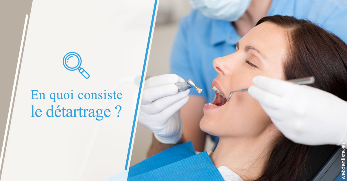 https://dr-patrice-gasser.chirurgiens-dentistes.fr/En quoi consiste le détartrage