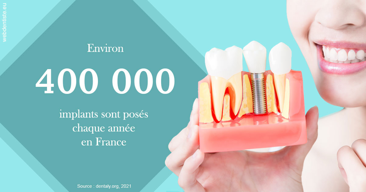 https://dr-patrice-gasser.chirurgiens-dentistes.fr/Pose d'implants en France 2