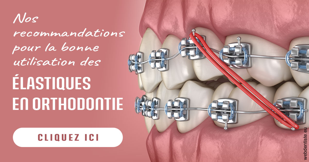 https://dr-patrice-gasser.chirurgiens-dentistes.fr/Elastiques orthodontie 2